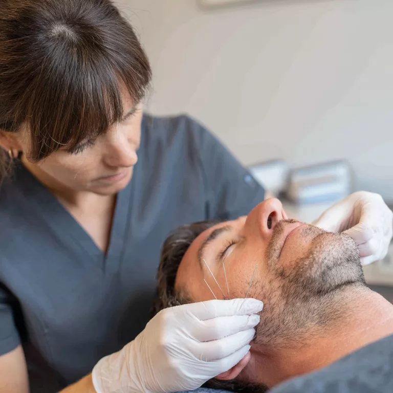 Agulhamento para dor miofascial